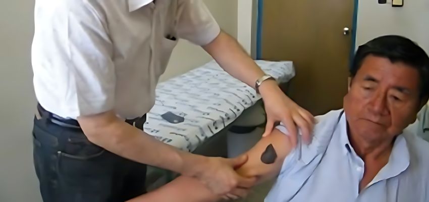 essalud lambayeque realizo campana gratuita de deteccion de cancer de piel